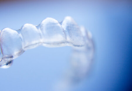 Image of Invisalign aligners