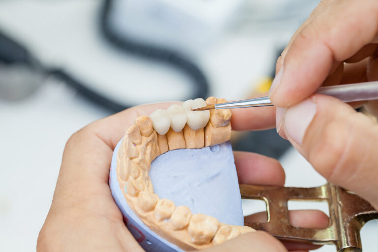 Dental model used to explain tooth alignment