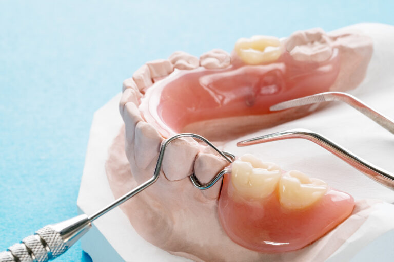 Dental model showing tooth positions