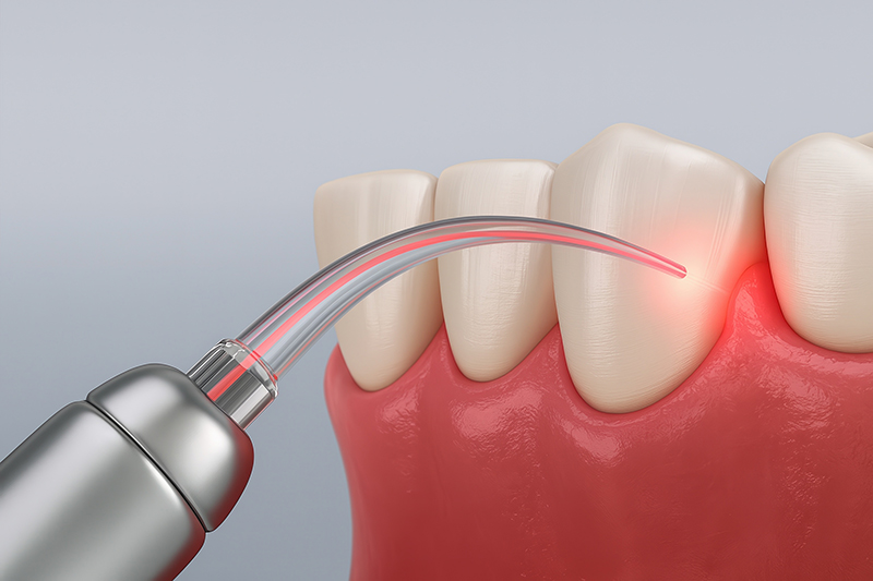 Illustration showing teeth and gums